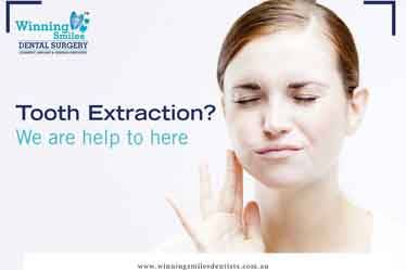 Everything You Need To Know About Wisdom Teeth Removal