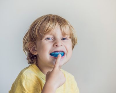 Mouthguard Awareness for Sports Season