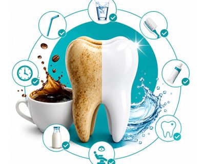 How to Prevent Coffee Stains on Teeth: 7 Effective Ways